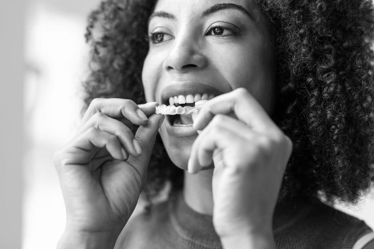 Modern-smiles-invisalign Modern smiles invisalign